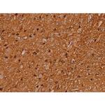 Phospho-Tau (Ser579) Antibody in Immunohistochemistry (Paraffin) (IHC (P))