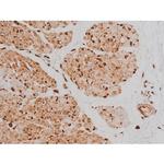 Phospho-Tau (Ser579) Polyclonal Antibody