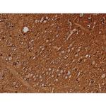 Phospho-Tau (Ser721) Antibody in Immunohistochemistry (Paraffin) (IHC (P))