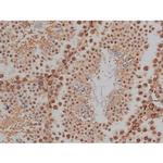 Phospho-Tau (Thr548) Antibody in Immunohistochemistry (Paraffin) (IHC (P))