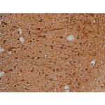Phospho-Tau (Thr548) Antibody in Immunohistochemistry (Paraffin) (IHC (P))