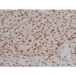 Phospho-Tau (Thr548) Antibody in Immunohistochemistry (Paraffin) (IHC (P))