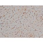Phospho-Tau (Thr548) Antibody in Immunohistochemistry (Paraffin) (IHC (P))