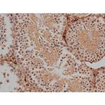 Phospho-Tau (Thr548) Antibody in Immunohistochemistry (Paraffin) (IHC (P))