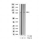 Phospho-Tau (Thr548) Antibody in Western Blot (WB)
