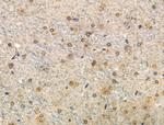 Phospho-Tau (Thr492, Thr175) Antibody in Immunohistochemistry (Paraffin) (IHC (P))