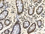 Phospho-TDP-43 (Ser409, Ser410) Antibody in Immunohistochemistry (Paraffin) (IHC (P))