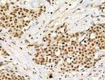 Phospho-TDP-43 (Ser409, Ser410) Antibody in Immunohistochemistry (Paraffin) (IHC (P))