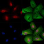 Phospho-TFEB (Ser211) Polyclonal Antibody