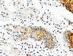 Phospho-TOPBP1 (Ser1138) Antibody in Immunohistochemistry (Paraffin) (IHC (P))