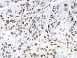 Phospho-TOPBP1 (Ser1138) Antibody in Immunohistochemistry (Paraffin) (IHC (P))