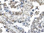 Phospho-TOPBP1 (Ser1138) Antibody in Immunohistochemistry (Paraffin) (IHC (P))