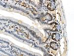 Phospho-TOPBP1 (Ser1138) Antibody in Immunohistochemistry (Paraffin) (IHC (P))