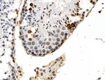 Phospho-TOPBP1 (Ser1138) Antibody in Immunohistochemistry (Paraffin) (IHC (P))