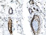 Phospho-TOPBP1 (Ser1138) Antibody in Immunohistochemistry (Paraffin) (IHC (P))