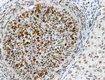 Phospho-TOPBP1 (Ser1138) Antibody in Immunohistochemistry (Paraffin) (IHC (P))