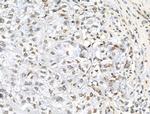 Phospho-TOPBP1 (Ser1138) Antibody in Immunohistochemistry (Paraffin) (IHC (P))