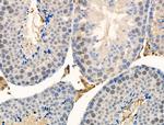 Phospho-UBA52 (Ser65) Polyclonal Antibody