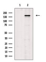 Phospho-VEGF Receptor 1 (Tyr1333) Polyclonal Antibody