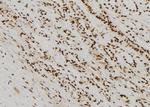 Phospho-Vimentin (Ser56) Antibody in Immunohistochemistry (Paraffin) (IHC (P))
