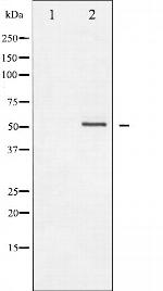 Phospho-Vimentin (Ser56) Antibody in Western Blot (WB)