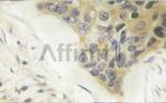 Phospho-Vimentin (Ser56) Antibody in Immunohistochemistry (Paraffin) (IHC (P))