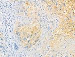 Phospho-XIRP1 (Ser295) Antibody in Immunohistochemistry (Paraffin) (IHC (P))