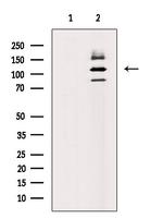 Phospho-XIRP1 (Ser295) Antibody in Western Blot (WB)