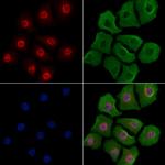 Phospho-YY1 (Ser365) Polyclonal Antibody