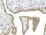 Phospho-YY1 (Ser365) Antibody in Immunohistochemistry (Paraffin) (IHC (P))