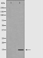 H3R8me2 Polyclonal Antibody