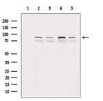 PARP1 (Cleaved Asp214) Polyclonal Antibody