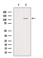 PARP1 (Cleaved Asp214) Antibody in Western Blot (WB)