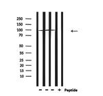 PARP1 (Cleaved Asp214) Antibody in Western Blot (WB)