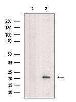 Caspase 7 (Cleaved Asp198) Polyclonal Antibody
