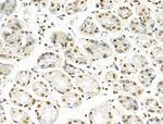 H2A.Zac pan-acetyl (K4,K7,K11,K13) Polyclonal Antibody