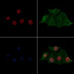 H2BK20ac Polyclonal Antibody