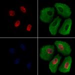 H4K12ac Polyclonal Antibody