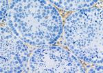 Rex1 Antibody in Immunohistochemistry (Paraffin) (IHC (P))