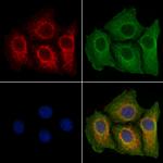 ADCY2 Polyclonal Antibody