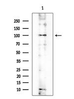ADCY2 Antibody in Western Blot (WB)