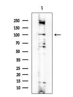 ADCY2 Antibody in Western Blot (WB)