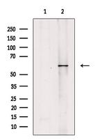 Calcium Channel beta-4 Polyclonal Antibody