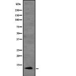 MIP-3 alpha Antibody in Western Blot (WB)
