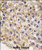 TRPV3 Polyclonal Antibody