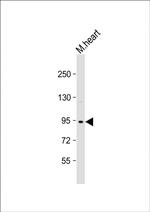 TRPV3 Antibody in Western Blot (WB)