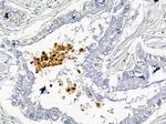 CD48 Antibody in Immunohistochemistry (Paraffin) (IHC (P))