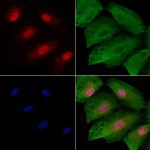 CIRBP Polyclonal Antibody