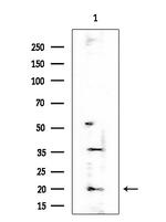 CIRBP Antibody in Western Blot (WB)