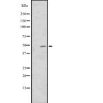 CNNM3 Polyclonal Antibody